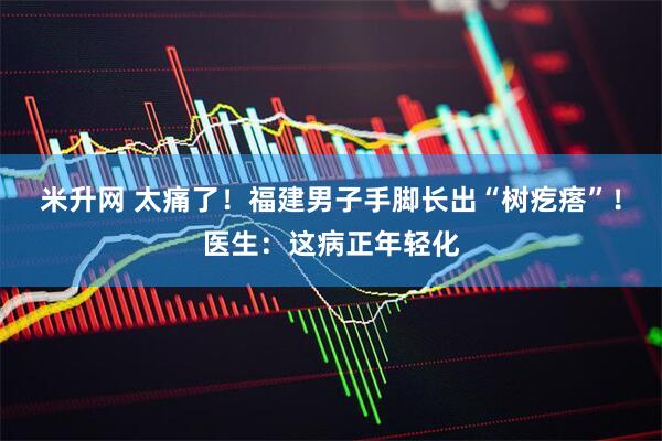米升网 太痛了！福建男子手脚长出“树疙瘩”！医生：这病正年轻化